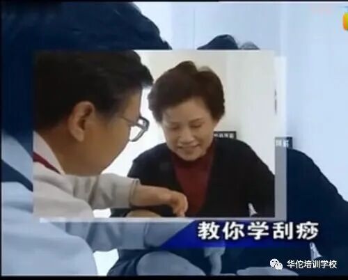 华佗怎么刮痧张秀勤中医全息刮痧教你刮痧保健康（二）教你头部刮痧_https://www.jmylbn.com_新闻资讯_第1张