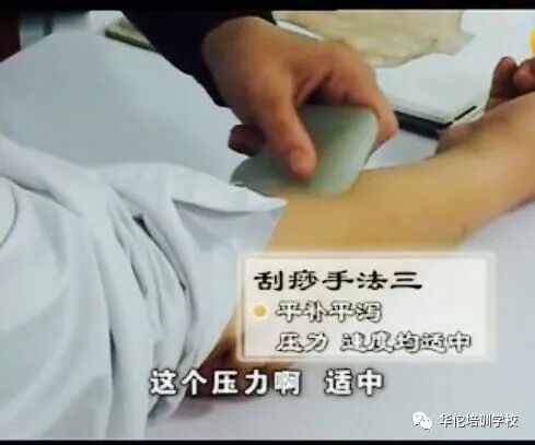 华佗怎么刮痧张秀勤中医全息刮痧教你刮痧保健康（二）教你头部刮痧_https://www.jmylbn.com_新闻资讯_第3张