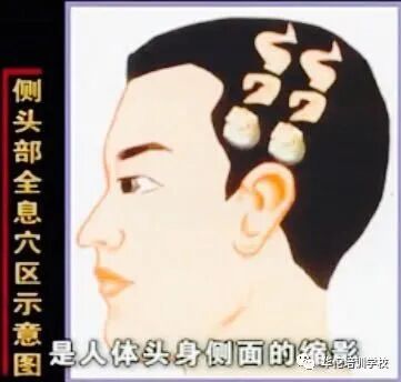 华佗怎么刮痧张秀勤中医全息刮痧教你刮痧保健康（二）教你头部刮痧_https://www.jmylbn.com_新闻资讯_第6张