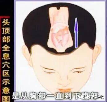 华佗怎么刮痧张秀勤中医全息刮痧教你刮痧保健康（二）教你头部刮痧_https://www.jmylbn.com_新闻资讯_第5张