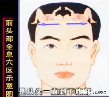 华佗怎么刮痧张秀勤中医全息刮痧教你刮痧保健康（二）教你头部刮痧_https://www.jmylbn.com_新闻资讯_第4张