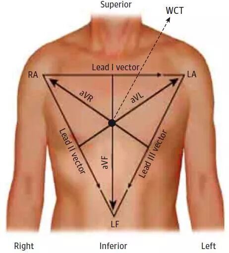 心电图怎么切换导联换个姿势来看心电图，打开一个全新的视角_https://www.jmylbn.com_新闻资讯_第3张
