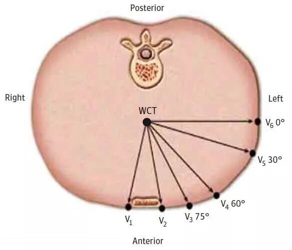 心电图怎么切换导联换个姿势来看心电图，打开一个全新的视角_https://www.jmylbn.com_新闻资讯_第4张