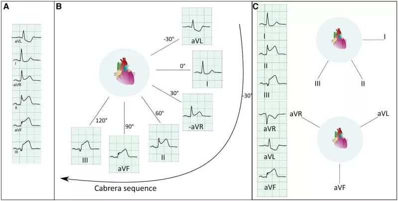 心电图怎么切换导联换个姿势来看心电图，打开一个全新的视角_https://www.jmylbn.com_新闻资讯_第7张