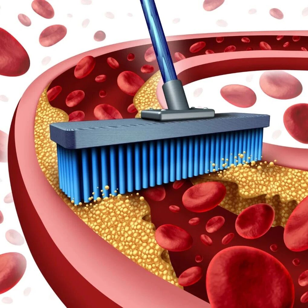 甘油三酯＞1.2时，开始有危害！2021EAS共识提供治疗策略