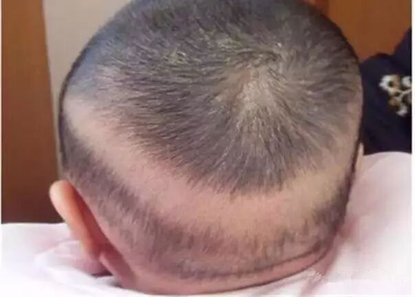 宝宝缺钙的9大表现这些特征早发现早治疗别耽搁