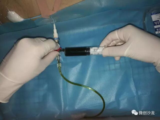 引流管怎么冲管居家护理：引流管看护和简单冲管_https://www.jmylbn.com_新闻资讯_第13张