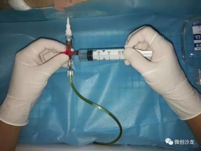 引流管怎么冲管居家护理：引流管看护和简单冲管_https://www.jmylbn.com_新闻资讯_第12张