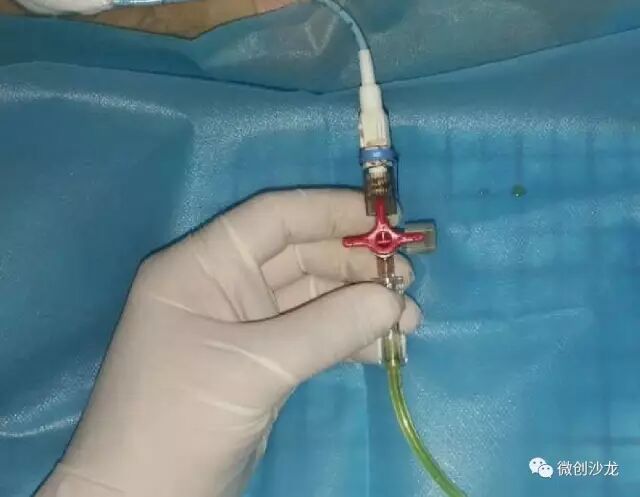 引流管怎么冲管居家护理：引流管看护和简单冲管_https://www.jmylbn.com_新闻资讯_第9张