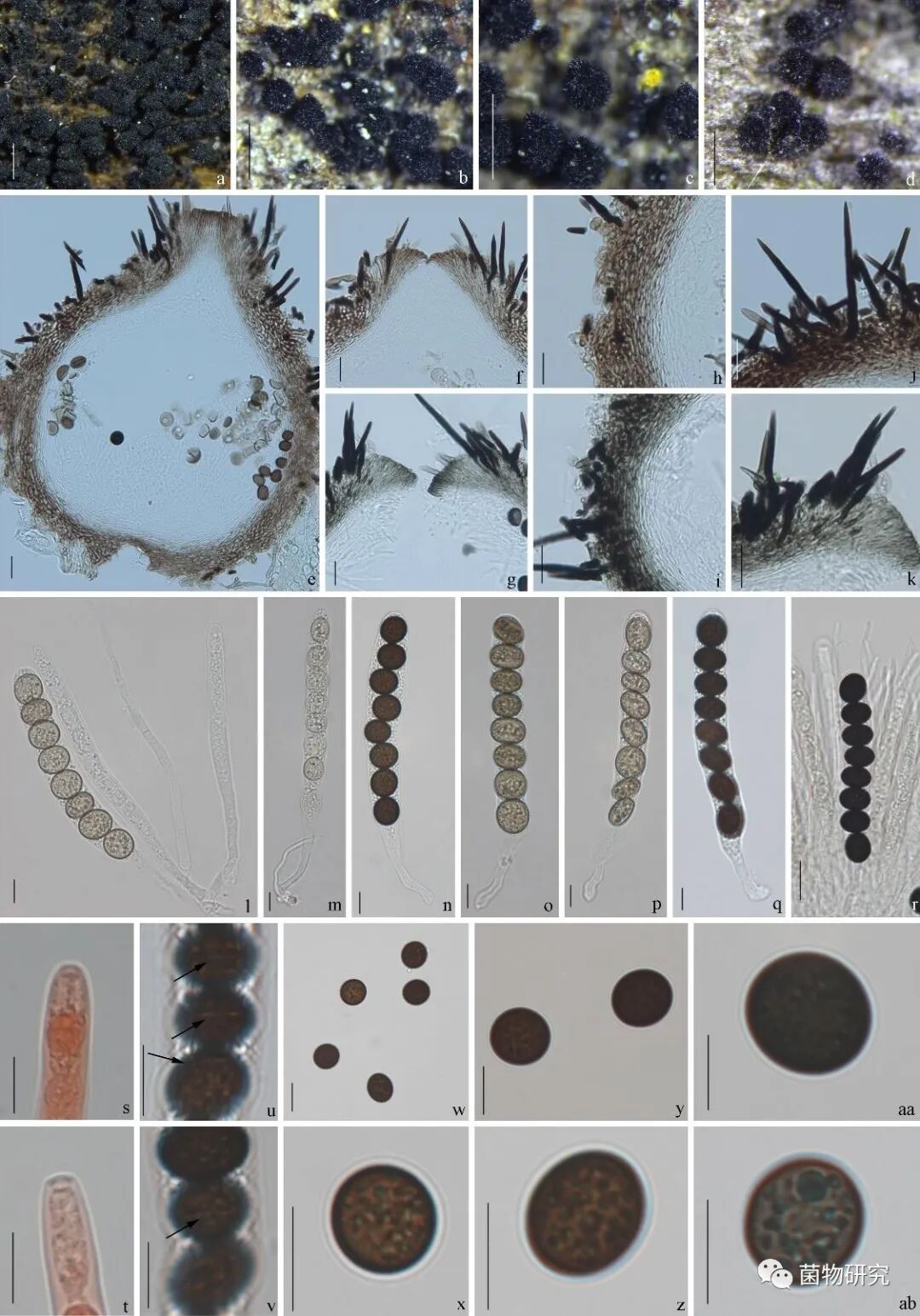 锥毛壳属2个亚洲新记录种 - 菌物研究 - 微信公众号文章 - 微小领
