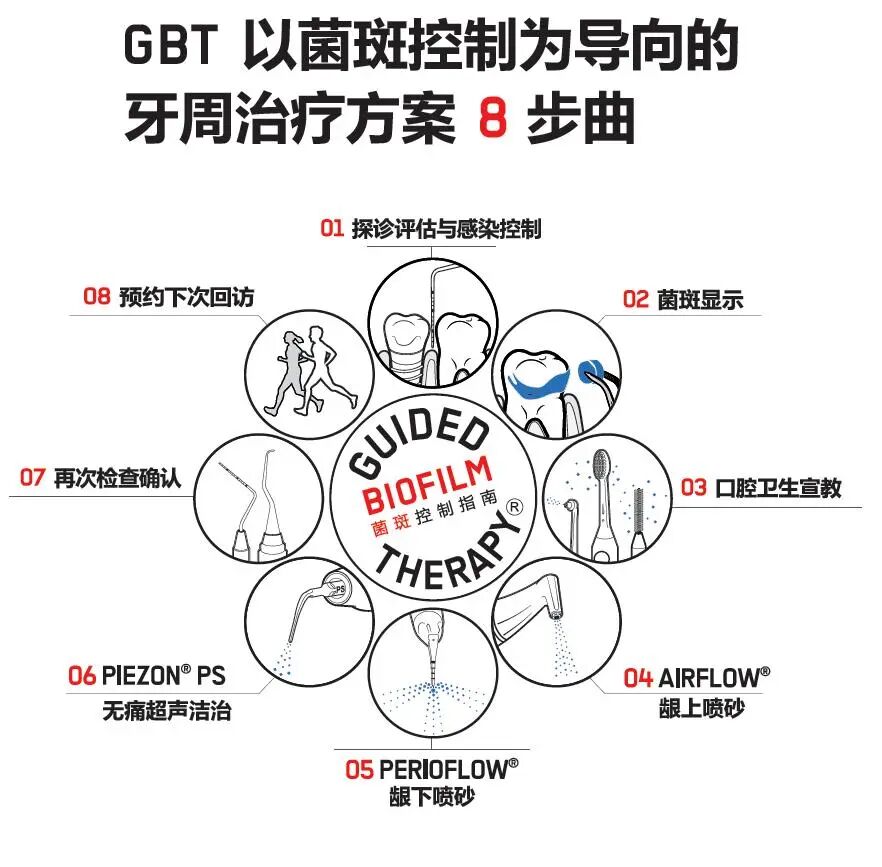 ems洁牙尖怎么分全功能牙周“机王”，带给您不一样的洗牙体验_https://www.jmylbn.com_新闻资讯_第5张