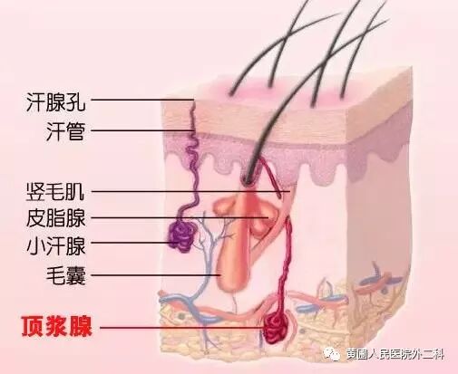 不用手术也能治疗腋臭（狐臭）——肉毒素注射