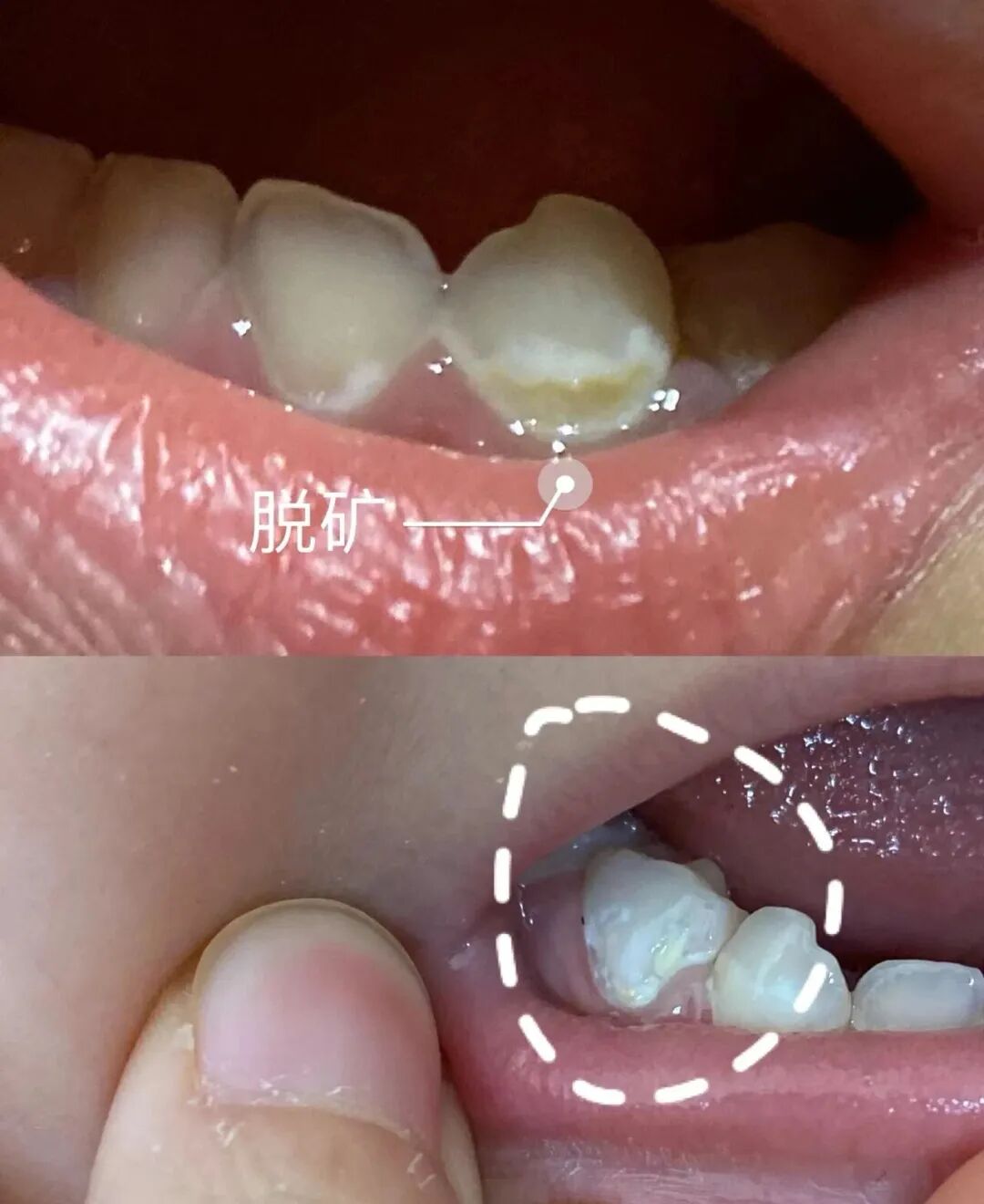 治疗床怎么用看着在治疗床上哇哇哭的孩子，“再也不敢了，这一件我还是老老实实给孩子买贵的…”_https://www.jmylbn.com_新闻资讯_第9张