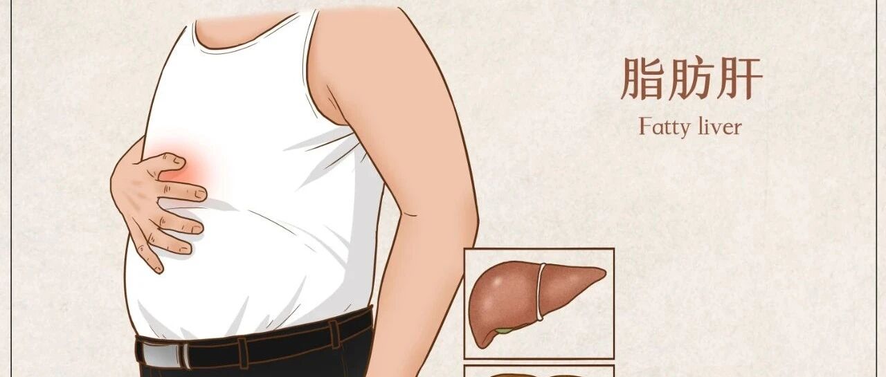 血脂高就会得脂肪肝吗？真相是……