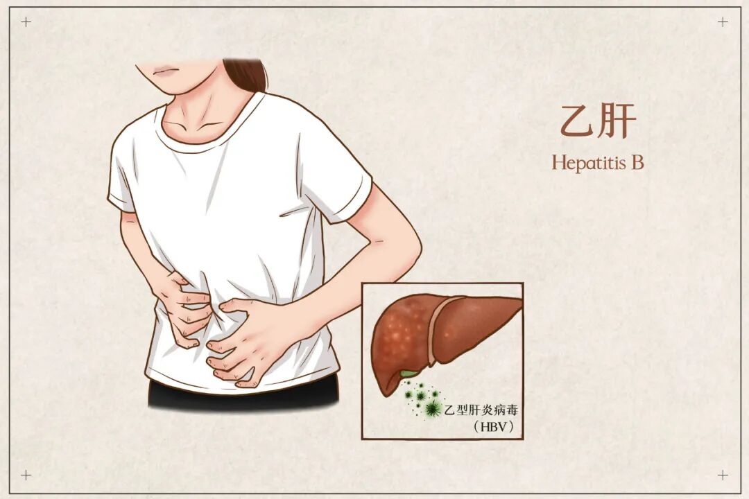 你真的知道什么是肝痛吗?_友友