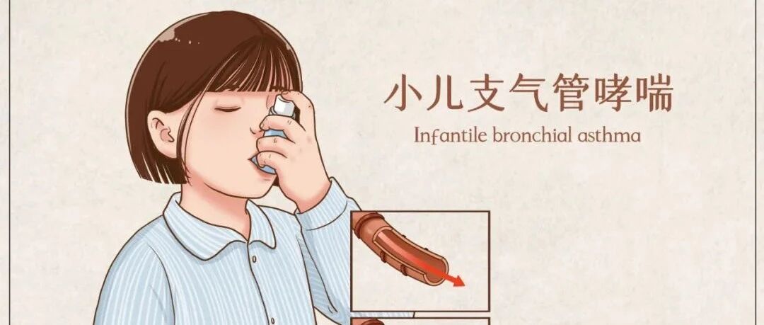 如何正确使用沙丁胺醇？并非吸一吸那么简单！