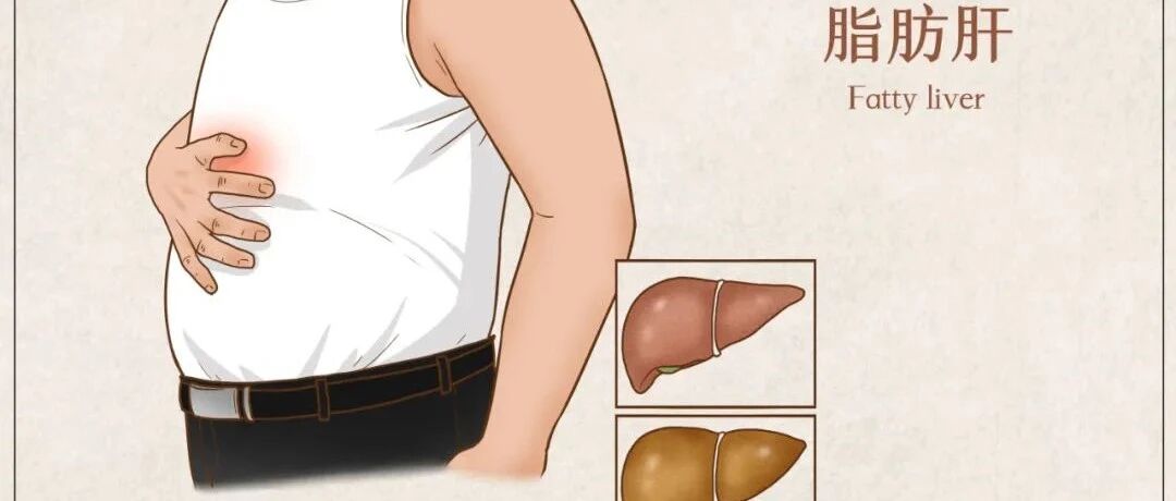 食物分3个等级，照着吃悄悄逆转脂肪肝