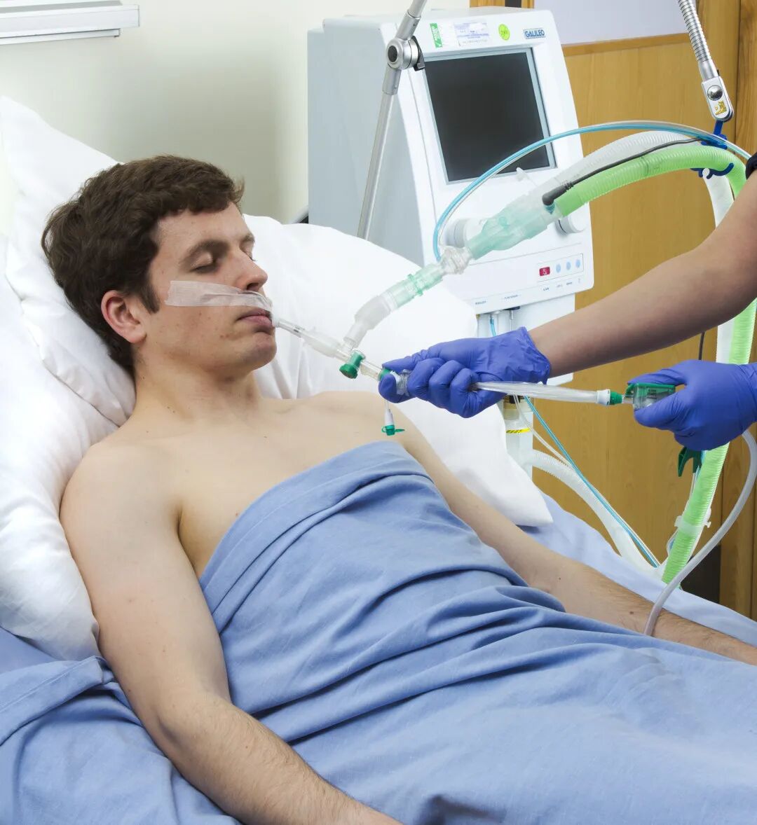 为什么使用密闭式吸痰管【COVID-19常见问题】密闭式吸痰管_https://www.jmylbn.com_新闻资讯_第2张