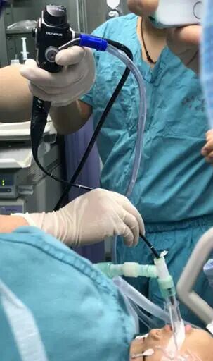 为什么要用喉罩i-gel喉罩的临床应用之无痛纤支镜诊疗_https://www.jmylbn.com_新闻资讯_第8张