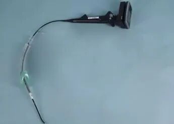 为什么要用喉罩i-gel喉罩的临床应用之无痛纤支镜诊疗_https://www.jmylbn.com_新闻资讯_第14张