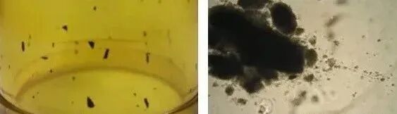 注塑加工产品出现黑点、杂质的原因及解决办法！的图1