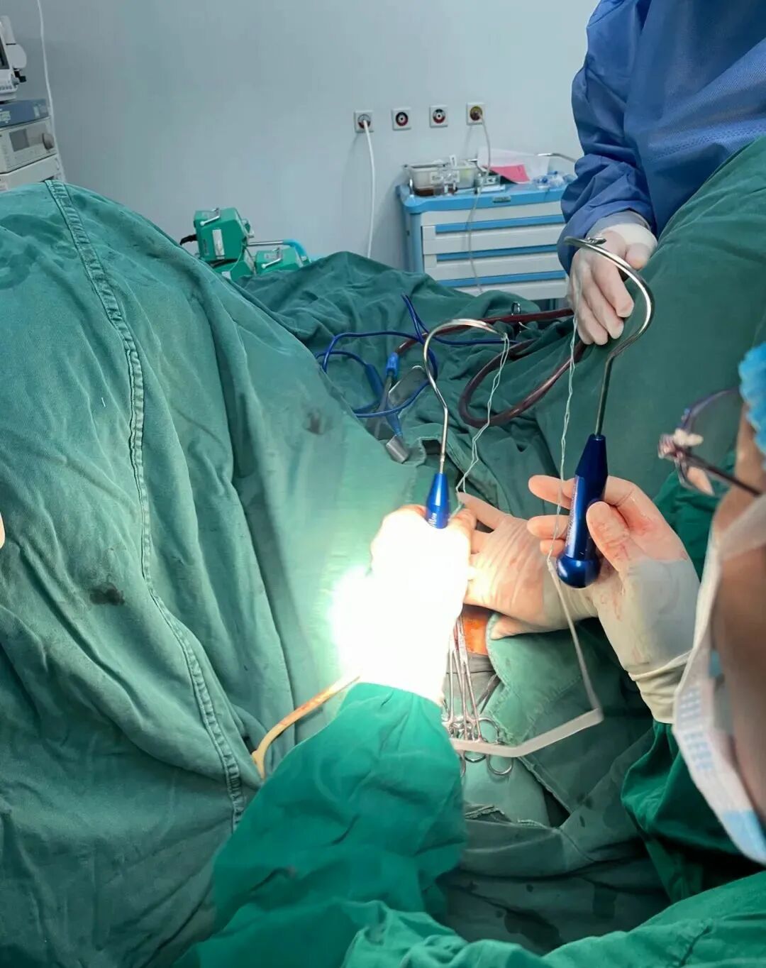 尿道张力过强怎么办【医学科普】经阴道闭孔无张力尿道悬吊术（TVT-O）_https://www.jmylbn.com_新闻资讯_第13张