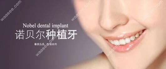 愈合机台怎么识别型号汇总诺贝尔种植体的不同型号和价格,还有愈合基台的型号哦_https://www.jmylbn.com_新闻资讯_第2张