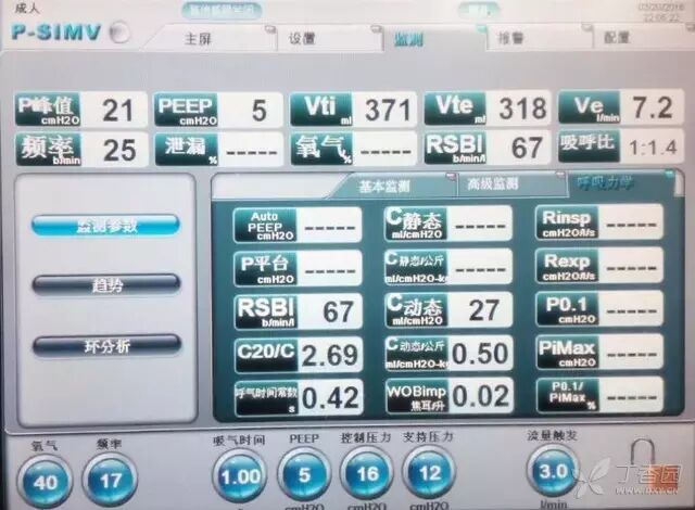 呼吸机f什么意思临床 ｜ 护士碰到呼吸机参数，不再慌！_https://www.jmylbn.com_新闻资讯_第5张