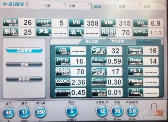 呼吸机f什么意思临床 ｜ 护士碰到呼吸机参数，不再慌！_https://www.jmylbn.com_新闻资讯_第6张