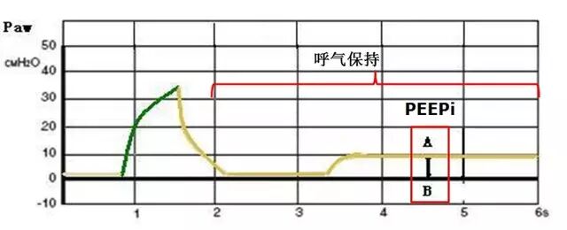 呼吸机f什么意思临床 ｜ 护士碰到呼吸机参数，不再慌！_https://www.jmylbn.com_新闻资讯_第7张