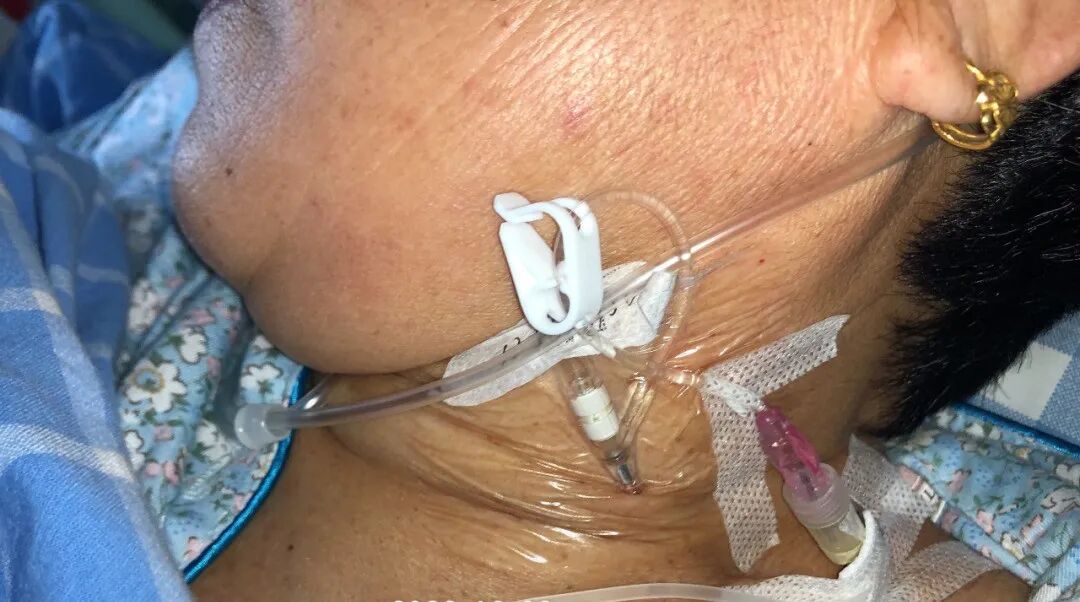 bd留置针怎么使用病人都休克了，留置针打不上怎么办？教你一招！_https://www.jmylbn.com_新闻资讯_第8张