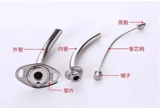 气管导管可用什么消毒金属气管内管，拔出困难怎么办？_https://www.jmylbn.com_新闻资讯_第2张