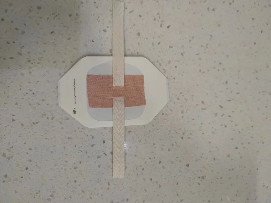 尿管怎么固定导尿管二次固定总是松脱？一招轻松解决！_https://www.jmylbn.com_新闻资讯_第9张