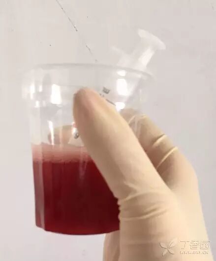 为什么新尿袋会漏尿尿管周围漏尿怎么办？解答关于留置导尿的 7 大问题_https://www.jmylbn.com_新闻资讯_第7张