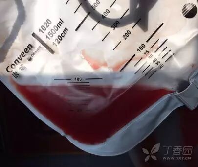 为什么新尿袋会漏尿护理知识｜遇到尿管周围漏尿，护士该怎么办？_https://www.jmylbn.com_新闻资讯_第6张