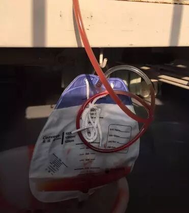 为什么新尿袋会漏尿尿管周围漏尿怎么办？解答关于留置导尿的 7 大问题_https://www.jmylbn.com_新闻资讯_第4张