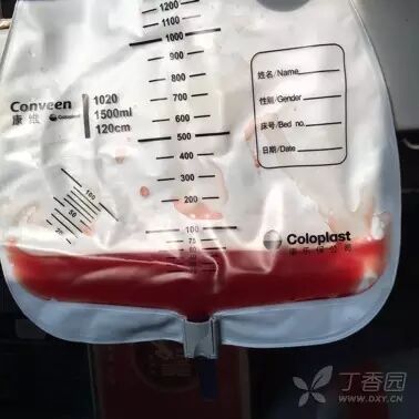 为什么新尿袋会漏尿护理知识｜遇到尿管周围漏尿，护士该怎么办？_https://www.jmylbn.com_新闻资讯_第5张