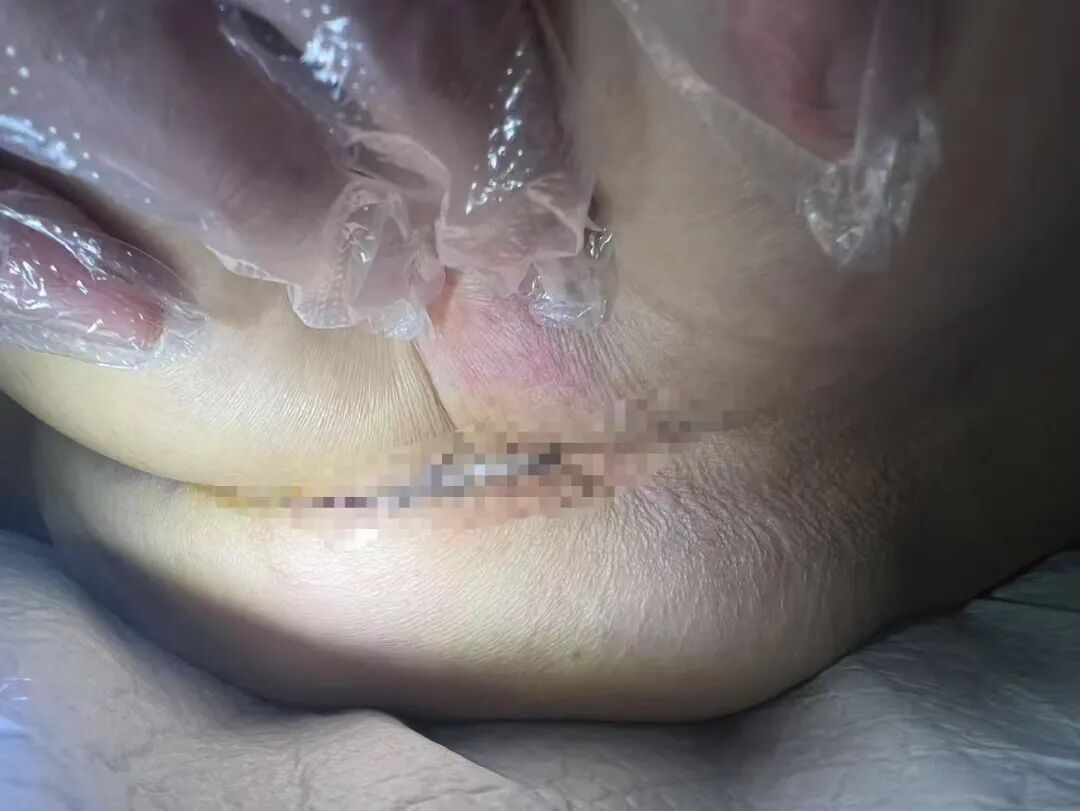 什么病忌用翻身床为什么医生特意强调不能翻身，护士：那皮肤压疮不查了？_https://www.jmylbn.com_新闻资讯_第2张