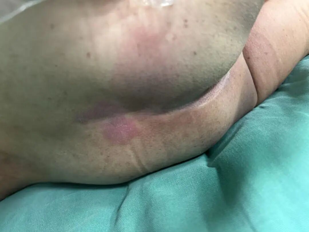 什么病忌用翻身床为什么医生特意强调不能翻身，护士：那皮肤压疮不查了？_https://www.jmylbn.com_新闻资讯_第4张