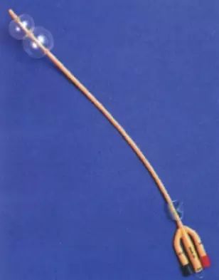 为什么要引流尿袋留置尿管到底几天更换一次？见尿为何要再插入？_https://www.jmylbn.com_新闻资讯_第7张