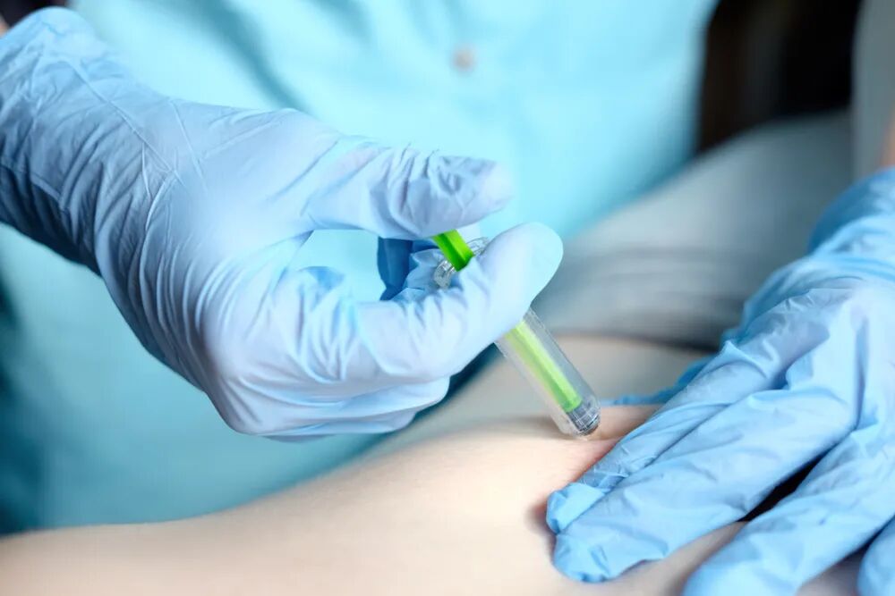 打肝素怎么拔针这都能发生针刺伤！工作 20 年也没听说过......_https://www.jmylbn.com_新闻资讯_第4张