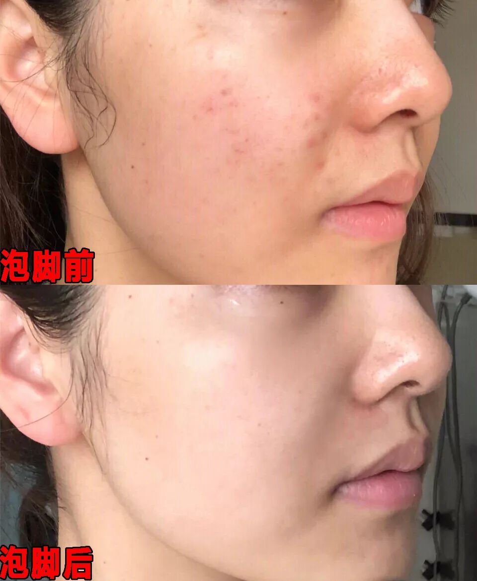 这才是高端足浴桶~按摩+泡脚+汗蒸,小贵,但很值~!-微信头条网 这才是高端足浴桶~按摩+泡脚+汗蒸,小贵,但很值~!