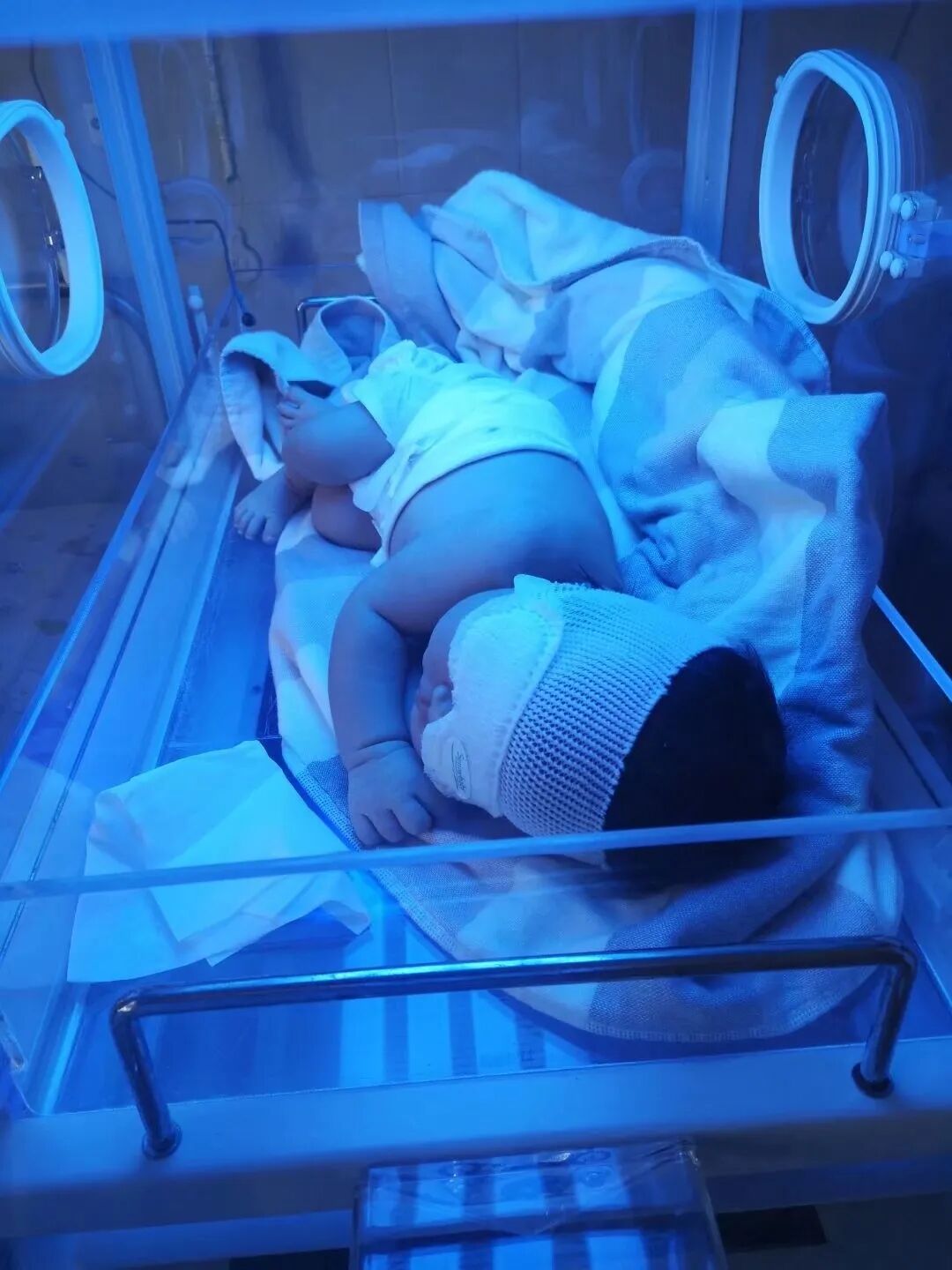 光疗箱报警怎么处理“黄“与”蓝“之——蓝光治疗_https://www.jmylbn.com_新闻资讯_第5张