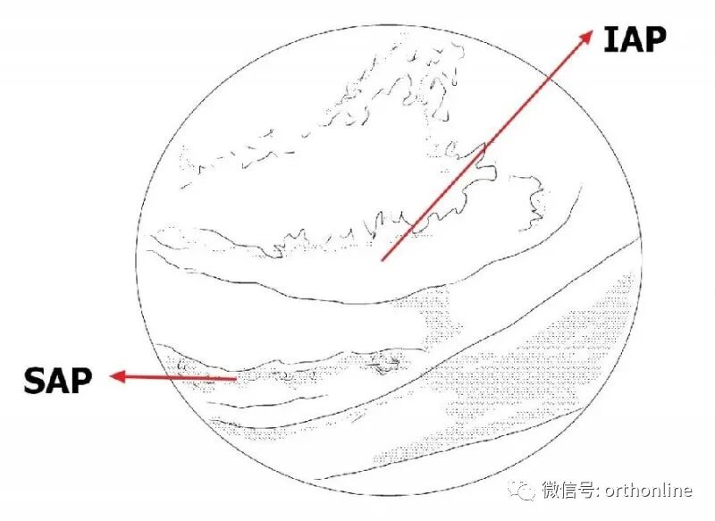 剥离子怎么使用临床必备 ｜ UBE神经剥离子的选择和使用_https://www.jmylbn.com_新闻资讯_第7张