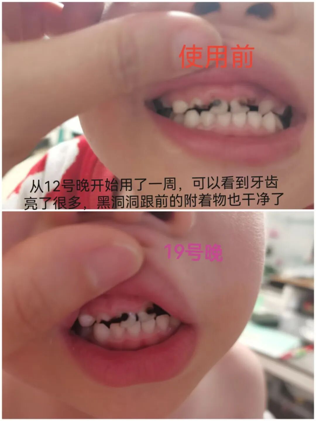 治疗床怎么用看着在治疗床上哇哇哭的孩子，“再也不敢了，这一件我还是老老实实给孩子买贵的…”_https://www.jmylbn.com_新闻资讯_第16张