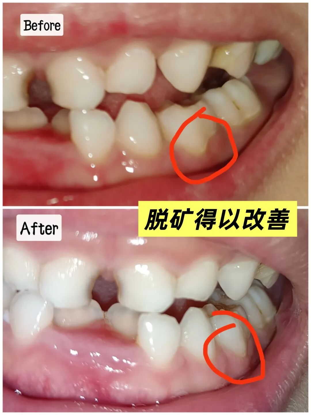 治疗床怎么用看着在治疗床上哇哇哭的孩子，“再也不敢了，这一件我还是老老实实给孩子买贵的…”_https://www.jmylbn.com_新闻资讯_第19张