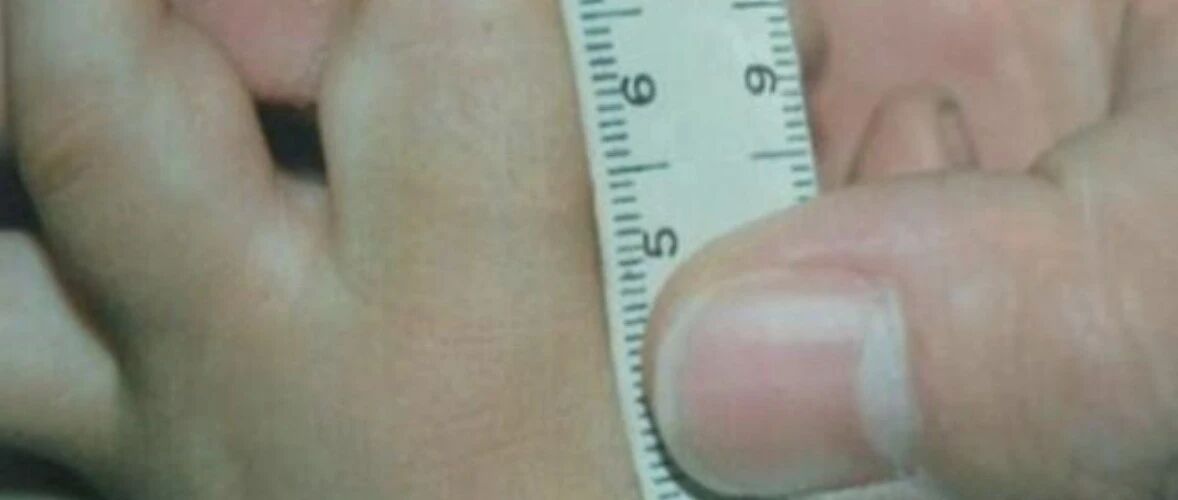 重伤、轻伤、轻微伤标准简化表（收藏）