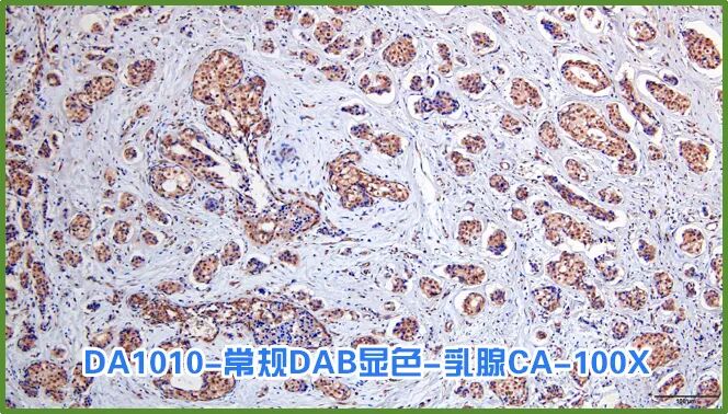 染色液|夏日大作战