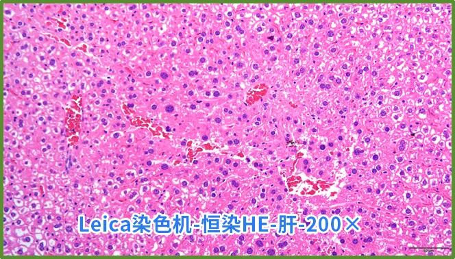 染色液|夏日大作战