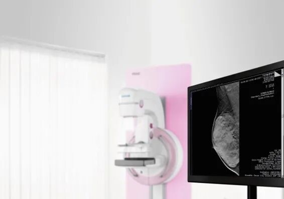 乳腺数字片又叫什么数字乳腺断层摄影技术知多少_https://www.jmylbn.com_新闻资讯_第2张